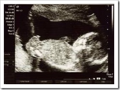 Ultrasound photo