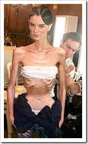 Anorexic model