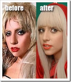 Lady Gaga before and after plastic surgery