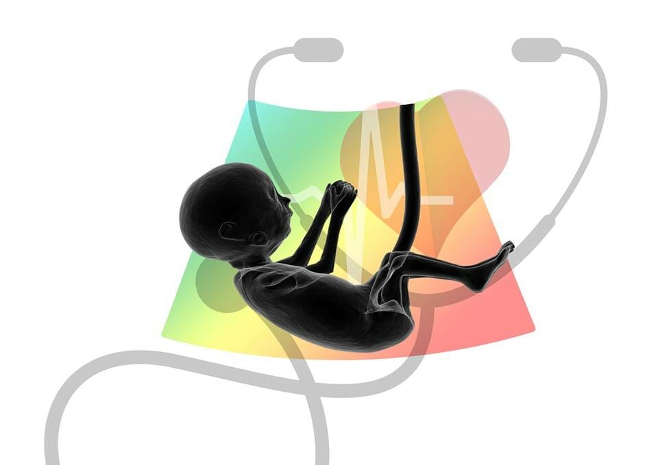 Fetus, sthetoscope and heartbeat graph